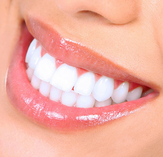laser safe teeth whitening
